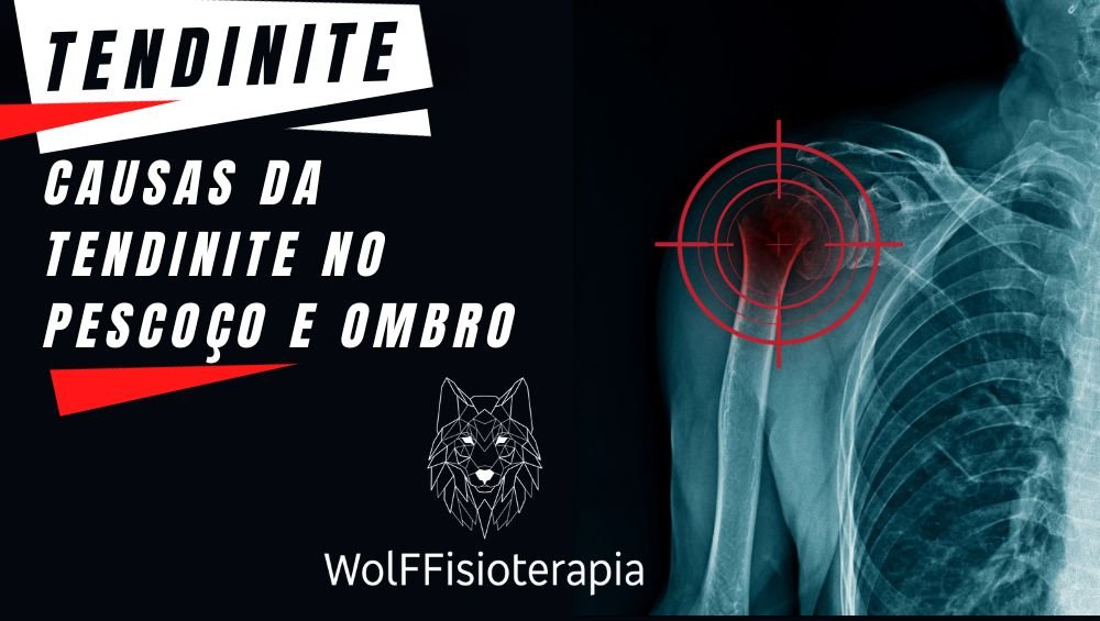 tendinite no ombro