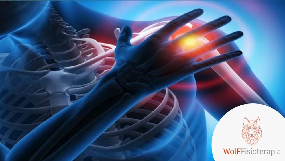 Tendinose do supraespinhal fisioterapia