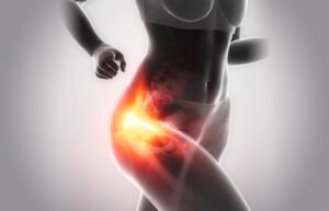 perguntas sobre tendinite de quadril