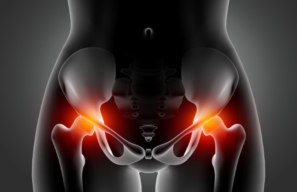 doenças no quadril